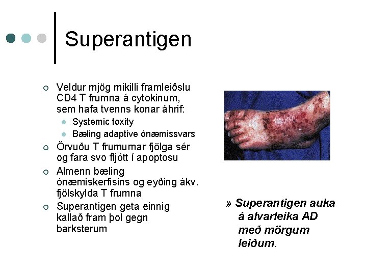 Superantigen ¢ Veldur mjög mikilli framleiðslu CD 4 T frumna á cytokinum, sem hafa