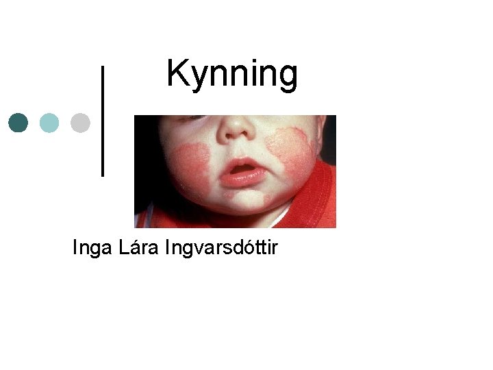 Kynning Inga Lára Ingvarsdóttir 