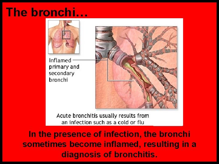 The bronchi… In the presence of infection, the bronchi sometimes become inflamed, resulting in
