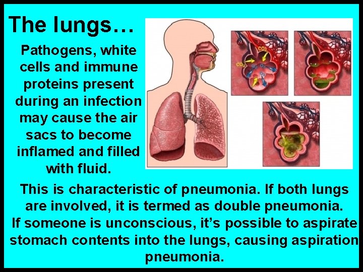 The lungs… Pathogens, white cells and immune proteins present during an infection may cause