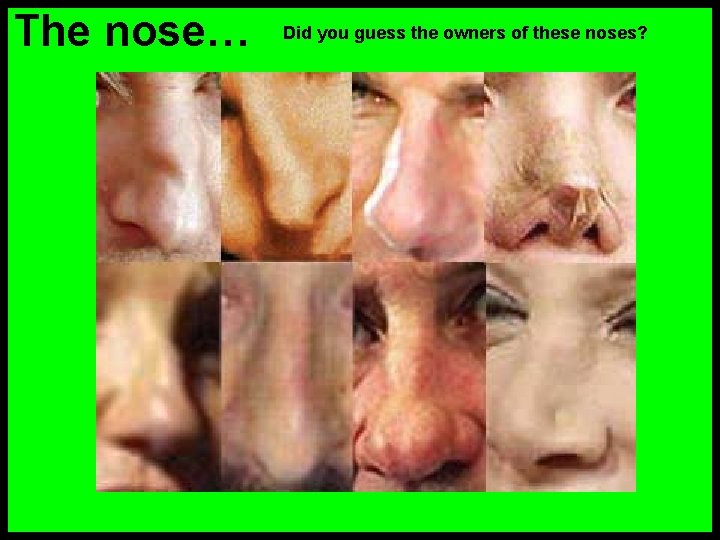 The nose… Did you guess the owners of these noses? Owen Wilson, Barbra Streisand,