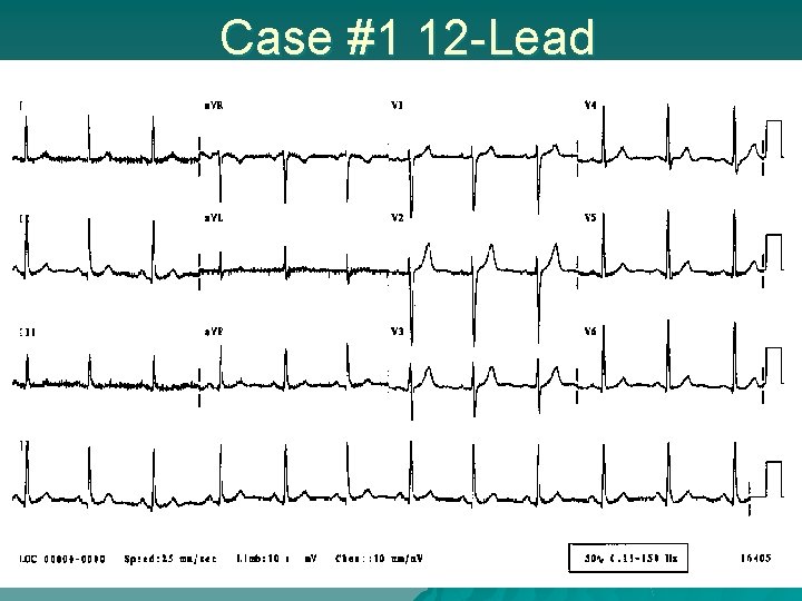 Case #1 12 -Lead 