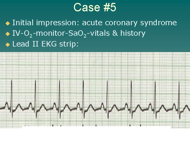 Case #5 Initial impression: acute coronary syndrome u IV-O 2 -monitor-Sa. O 2 -vitals
