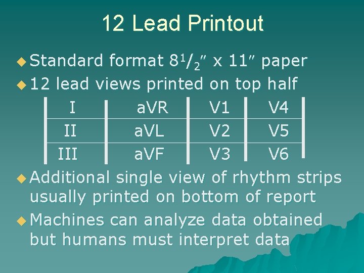 12 Lead Printout u Standard format 81/2 x 11 paper u 12 lead views