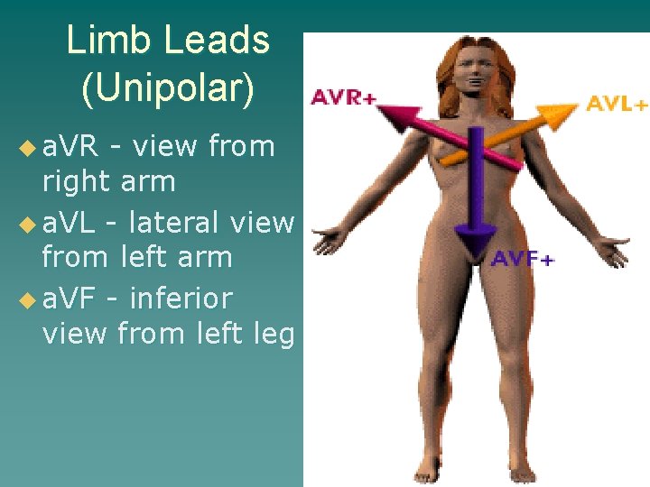 Limb Leads (Unipolar) u a. VR - view from right arm u a. VL