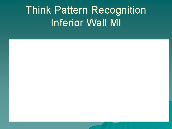 Think Pattern Recognition Inferior Wall MI 