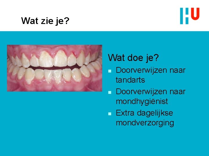 Wat zie je? Wat doe je? n n n Doorverwijzen naar tandarts Doorverwijzen naar Wat zie je? Wat doe je? n n n Doorverwijzen naar tandarts Doorverwijzen naar