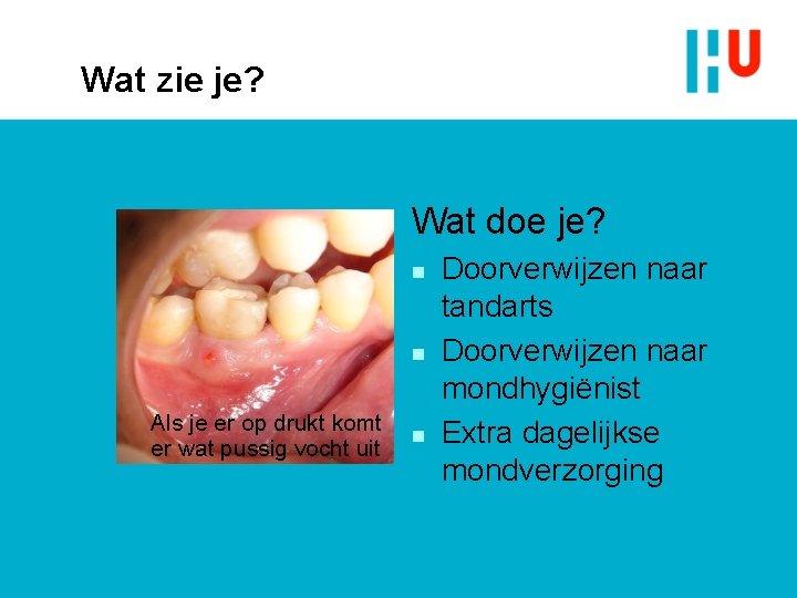 Wat zie je? Wat doe je? n n Als je er op drukt komt