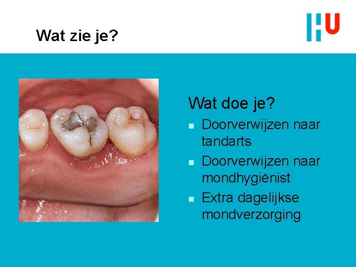 Wat zie je? Wat doe je? n n n Doorverwijzen naar tandarts Doorverwijzen naar Wat zie je? Wat doe je? n n n Doorverwijzen naar tandarts Doorverwijzen naar