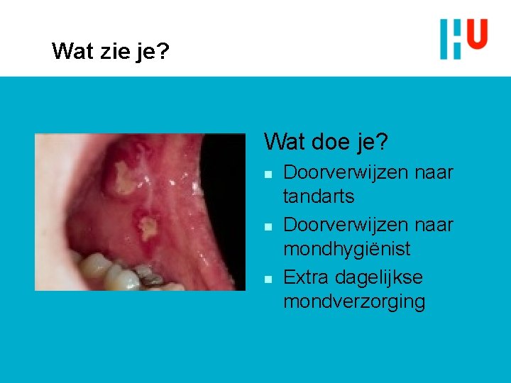 Wat zie je? Wat doe je? n n n Doorverwijzen naar tandarts Doorverwijzen naar Wat zie je? Wat doe je? n n n Doorverwijzen naar tandarts Doorverwijzen naar