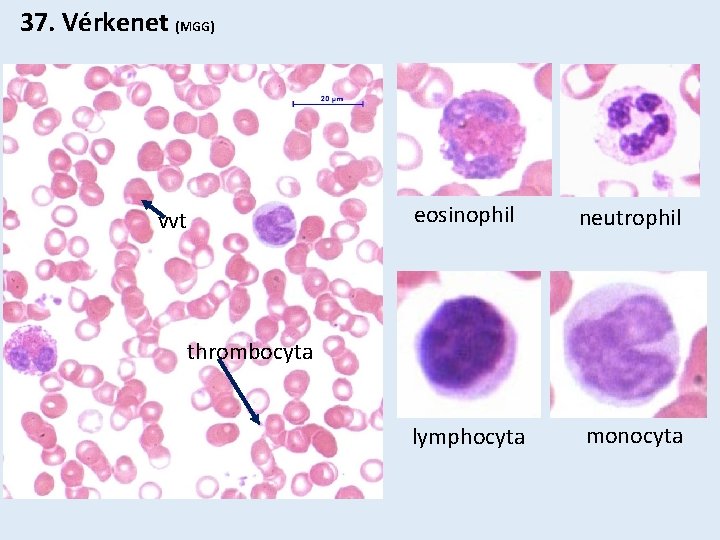 37. Vérkenet (MGG) vvt eosinophil neutrophil lymphocyta monocyta thrombocyta 