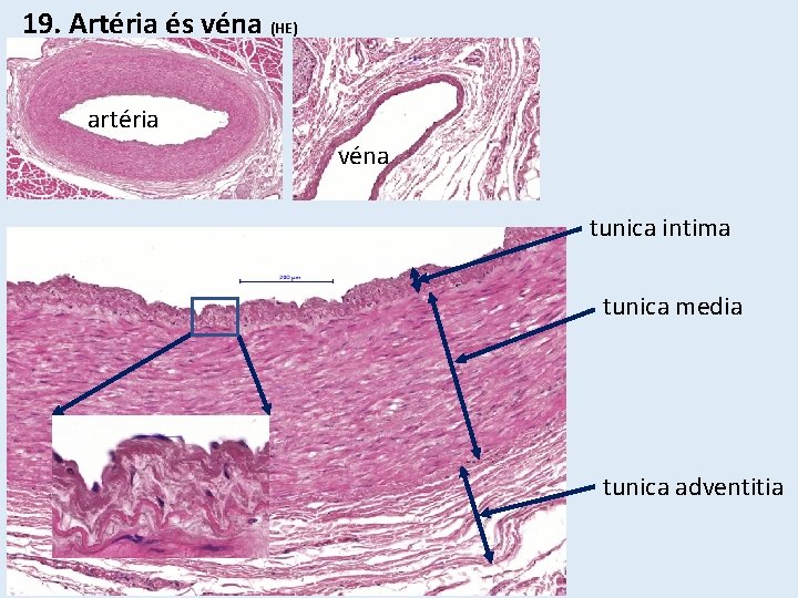 19. Artéria és véna (HE) artéria véna tunica intima tunica media tunica adventitia 