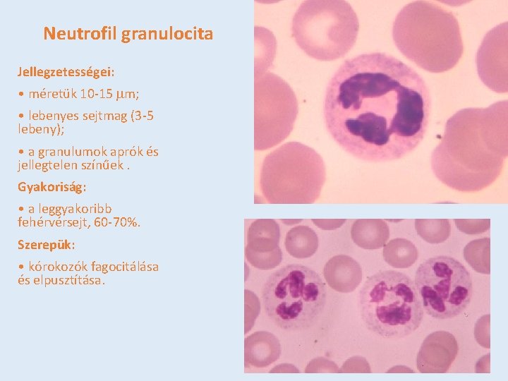 Neutrofil granulocita Jellegzetességei: • méretük 10 -15 mm; • lebenyes sejtmag (3 -5 lebeny);