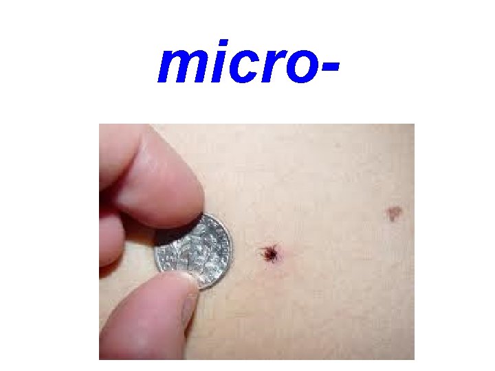 micro- 