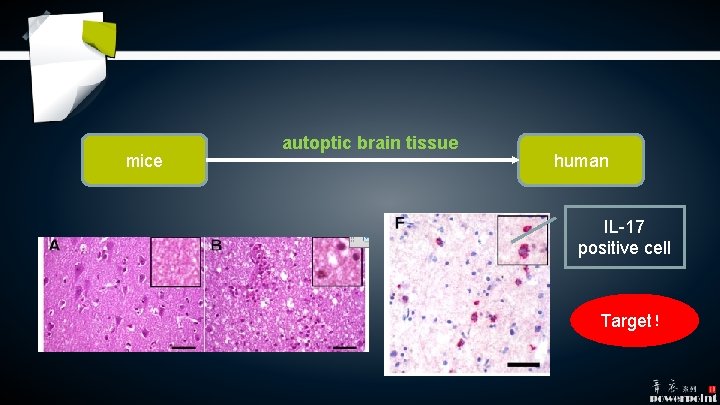 mice autoptic brain tissue human IL-17 positive cell Target! mice autoptic brain tissue human IL-17 positive cell Target!