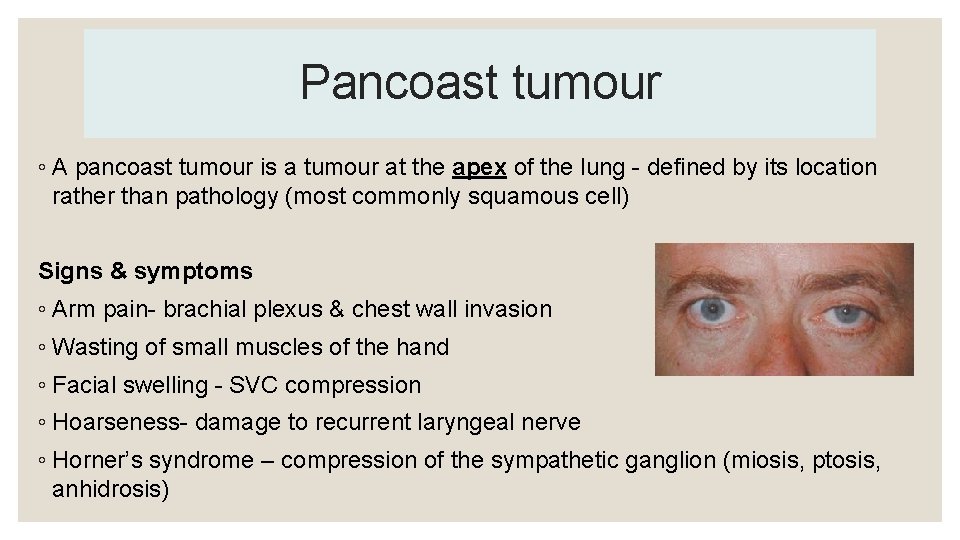 Pancoast tumour ◦ A pancoast tumour is a tumour at the apex of the