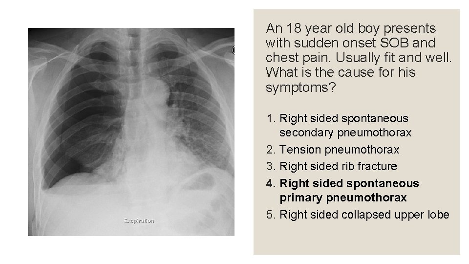 An 18 year old boy presents with sudden onset SOB and chest pain. Usually