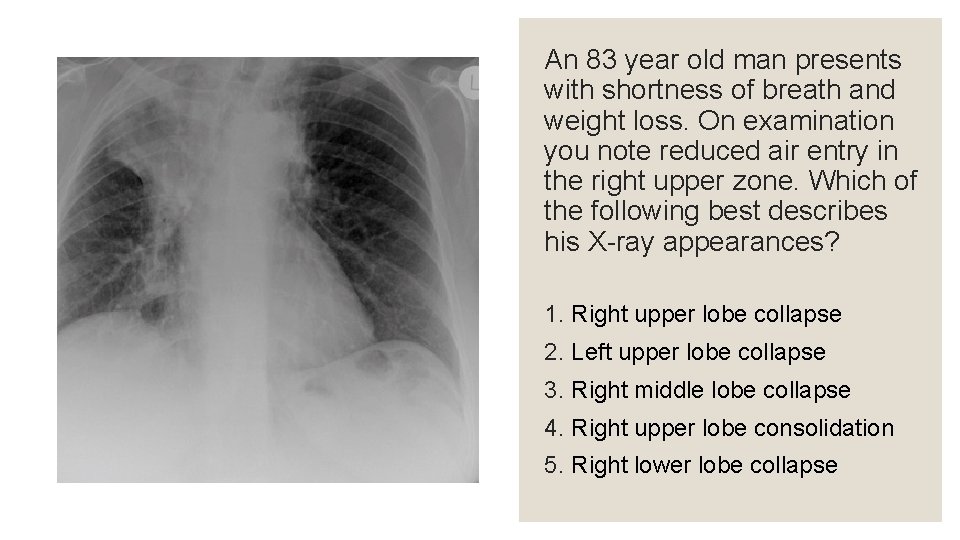 An 83 year old man presents with shortness of breath and weight loss. On