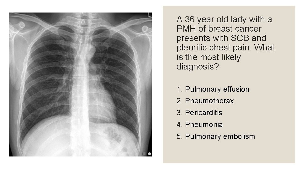 A 36 year old lady with a PMH of breast cancer presents with SOB