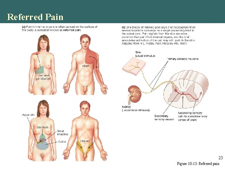 Referred Pain 23 Figure 10 -13: Referred pain Referred Pain 23 Figure 10 -13: Referred pain