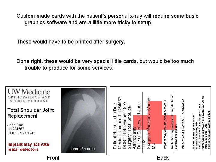 Total Shoulder Joint Replacement John Doe U 1234567 DOB: 07/27/1945 Implant may activate metal