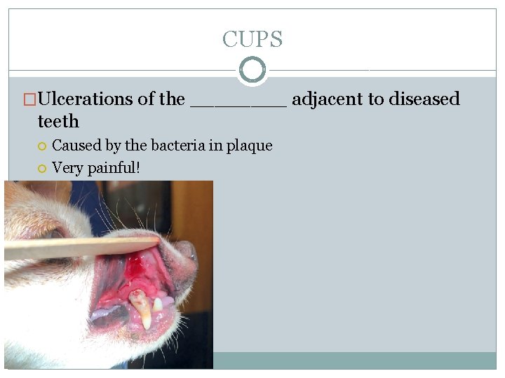 CUPS �Ulcerations of the ____ adjacent to diseased teeth Caused by the bacteria in