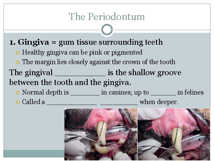 The Periodontum 1. Gingiva = gum tissue surrounding teeth Healthy gingiva can be pink