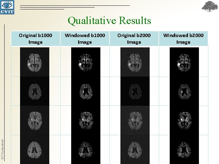 Qualitative Results IIIT Hyderabad Original b 1000 Image Windowed b 1000 Image Original b Qualitative Results IIIT Hyderabad Original b 1000 Image Windowed b 1000 Image Original b