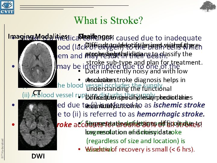 What is Stroke? Imaging Modalities: Need: • Stroke is a medical. Challenges: condition caused What is Stroke? Imaging Modalities: Need: • Stroke is a medical. Challenges: condition caused
