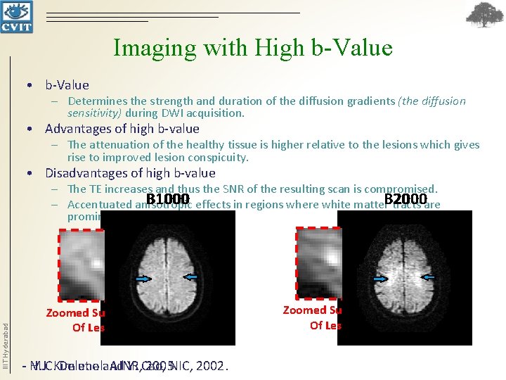 Imaging with High b-Value • b-Value – Determines the strength and duration of the Imaging with High b-Value • b-Value – Determines the strength and duration of the