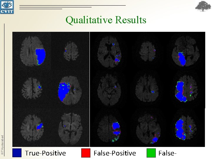 IIIT Hyderabad Qualitative Results True-Positive False- IIIT Hyderabad Qualitative Results True-Positive False-