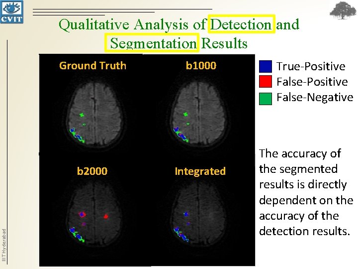 Qualitative Analysis of Detection and Segmentation Results Ground Truth IIIT Hyderabad b 2000 b Qualitative Analysis of Detection and Segmentation Results Ground Truth IIIT Hyderabad b 2000 b