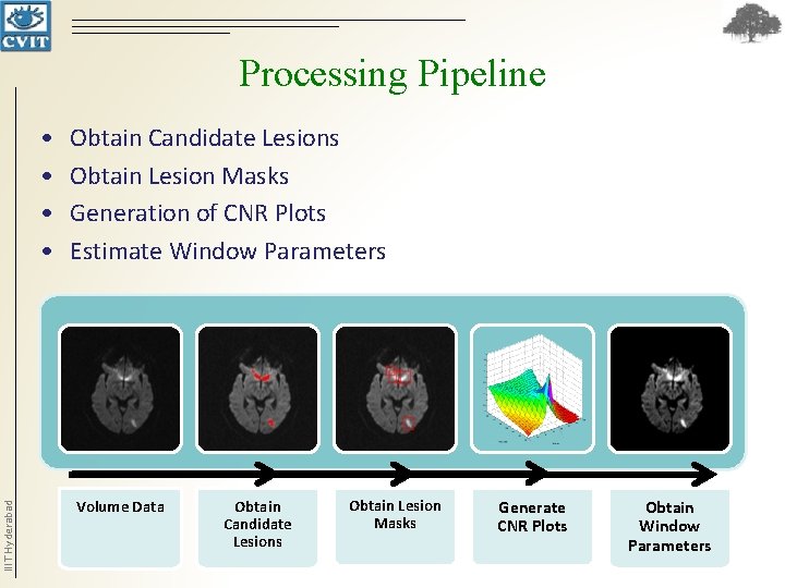 Processing Pipeline IIIT Hyderabad • • Obtain Candidate Lesions Obtain Lesion Masks Generation of Processing Pipeline IIIT Hyderabad • • Obtain Candidate Lesions Obtain Lesion Masks Generation of