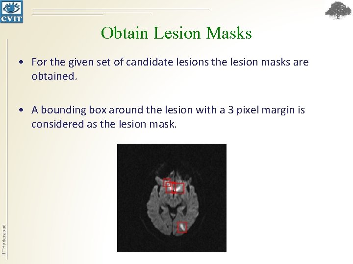 Obtain Lesion Masks • For the given set of candidate lesions the lesion masks Obtain Lesion Masks • For the given set of candidate lesions the lesion masks