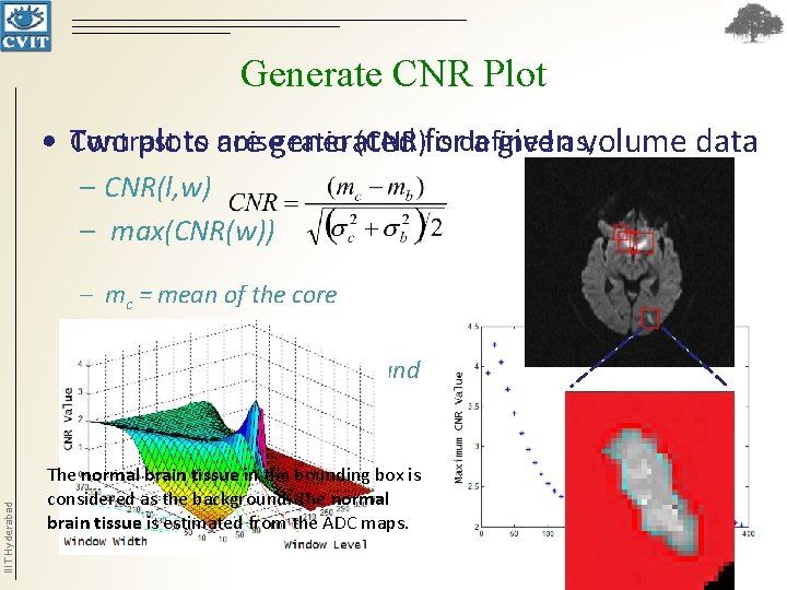 Generate CNR Plot Contrast to are noisegenerated ratio (CNR)for is defined • Two plots Generate CNR Plot Contrast to are noisegenerated ratio (CNR)for is defined • Two plots