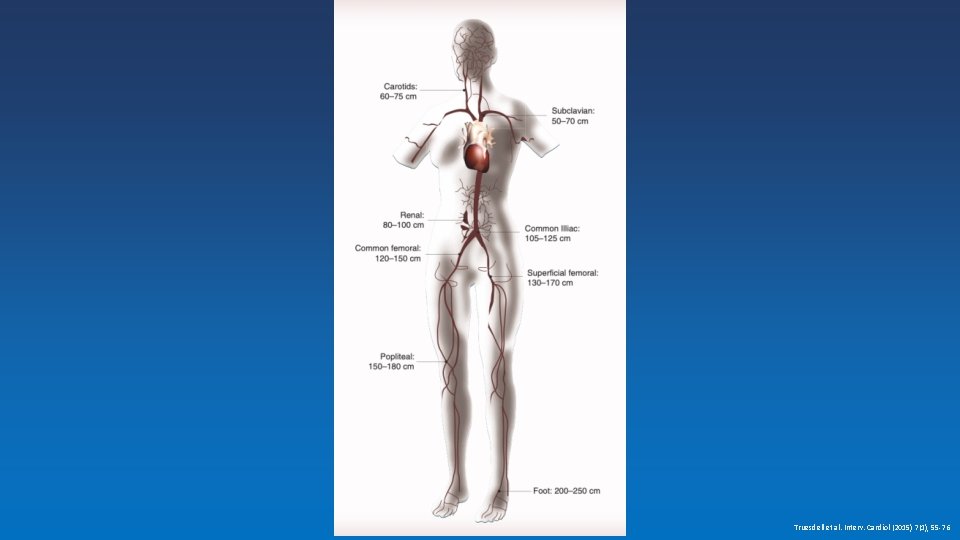 Truesdell et al. Interv. Cardiol (2015) 7(1), 55 -76 