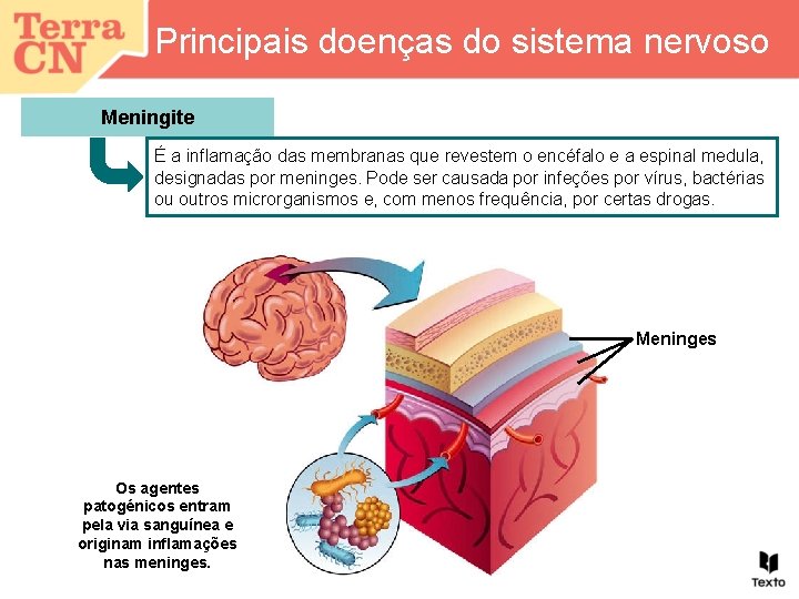 Principais doenças do sistema nervoso Meningite É a inflamação das membranas que revestem o