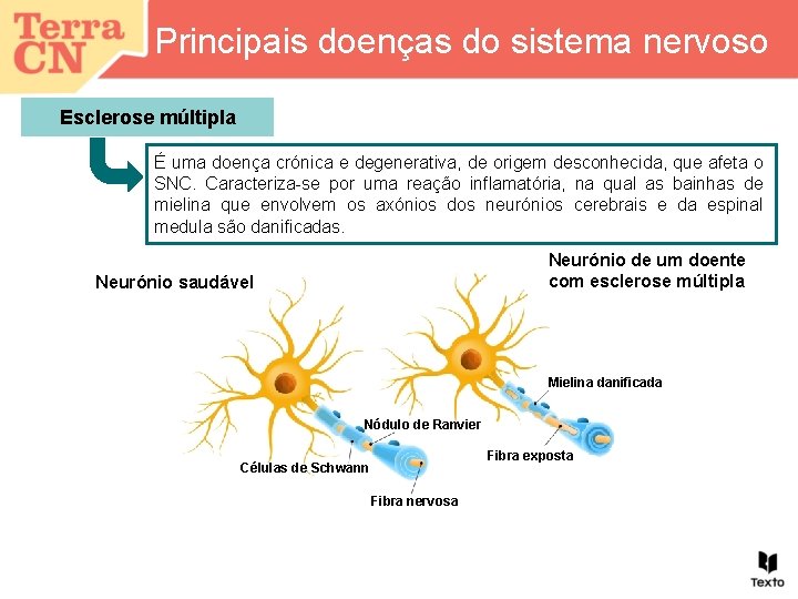 Principais doenças do sistema nervoso Esclerose múltipla É uma doença crónica e degenerativa, de