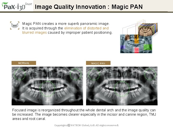 Image Quality Innovation : Magic PAN creates a more superb panoramic image. It is