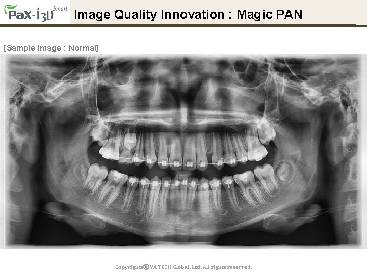 Image Quality Innovation : Magic PAN [Sample Image : Normal] Copyrightsⓒ VATECH Global, Ltd.