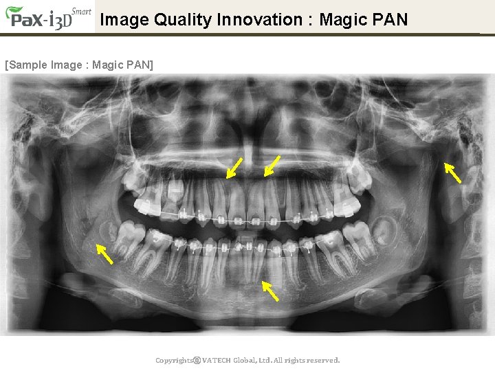 Image Quality Innovation : Magic PAN [Sample Image : Magic PAN] Copyrightsⓒ VATECH Global,