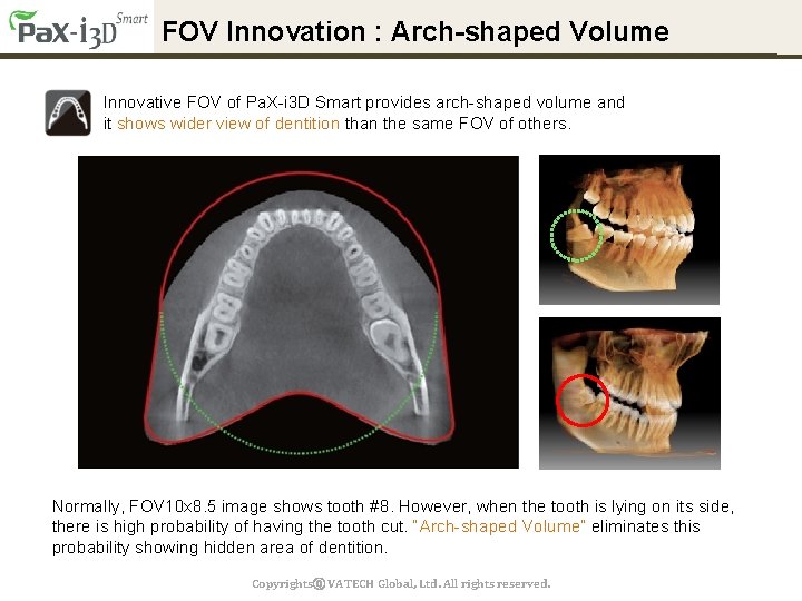FOV Innovation : Arch-shaped Volume Innovative FOV of Pa. X-i 3 D Smart provides