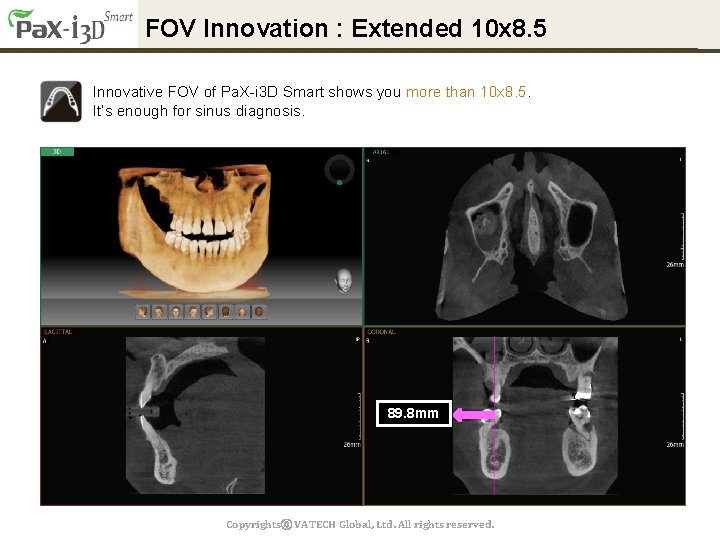 FOV Innovation : Extended 10 x 8. 5 Innovative FOV of Pa. X-i 3