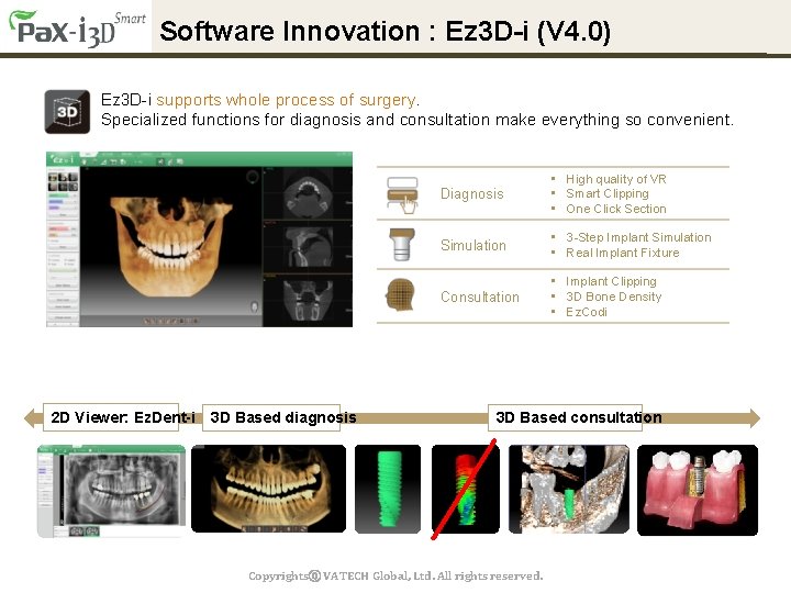 Software Innovation : Ez 3 D-i (V 4. 0) Ez 3 D-i supports whole