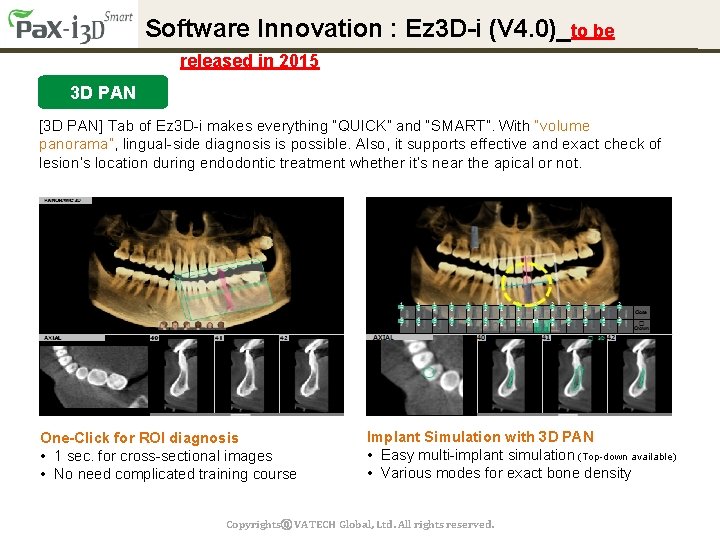 Software Innovation : Ez 3 D-i (V 4. 0)_to be released in 2015 3