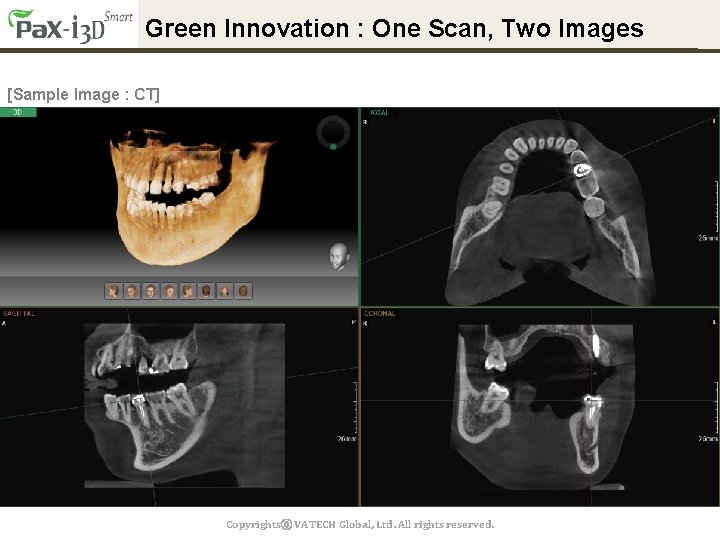 Green Innovation : One Scan, Two Images [Sample Image : CT] Copyrightsⓒ VATECH Global,