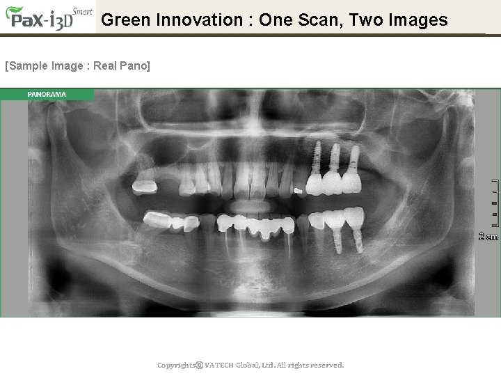 Green Innovation : One Scan, Two Images [Sample Image : Real Pano] Copyrightsⓒ VATECH