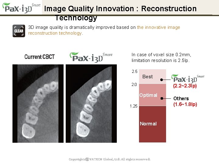 Image Quality Innovation : Reconstruction Technology 3 D image quality is dramatically improved based