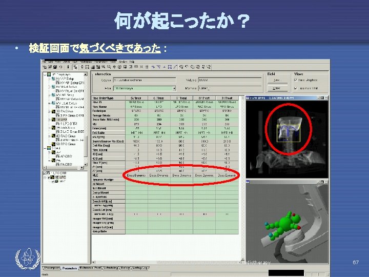 何が起こったか？ • 検証画面で気づくべきであった : IAEA Prevention of accidental exposure in radiotherapy 67 