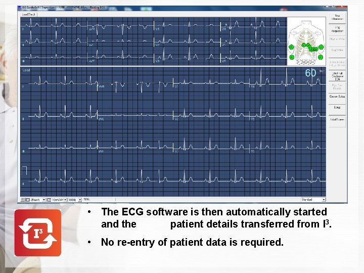  • The ECG software is then automatically started and the patient details transferred